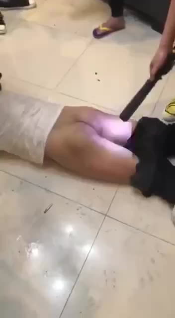 缅北园区挨打割腰子